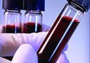 Desarrollan sangre artificial que podría salvar muchas vidas