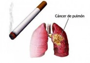 El cáncer de pulmón y los hispanos: preguntas y respuestas